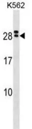 Anti-IL15 Receptor alpha antibody used in Western Blot (WB). GTX53652