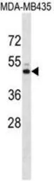 Anti-Kir7.1 antibody used in Western Blot (WB). GTX53659