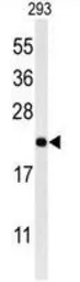 Anti-MRAP antibody used in Western Blot (WB). GTX53669