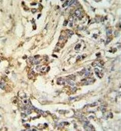 Anti-MRAP antibody used in IHC (Paraffin sections) (IHC-P). GTX53669