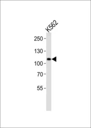 Anti-MIB1 antibody used in Western Blot (WB). GTX53672