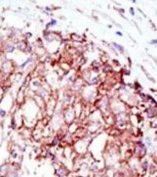 Anti-MIB1 antibody used in IHC (Paraffin sections) (IHC-P). GTX53672
