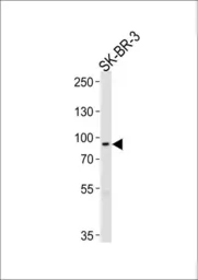 Anti-MTIF2 antibody used in Western Blot (WB). GTX53673