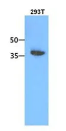 Anti-ACOT7 antibody [AT1D5] used in Western Blot (WB). GTX53682