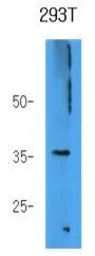 Anti-AKR7A3 antibody [AT2E11] used in Western Blot (WB). GTX53685