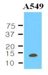 Anti-Cystatin B antibody [2F1] used in Western Blot (WB). GTX53707