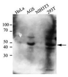 Anti-CtBP1 antibody [AT4D6] used in Western Blot (WB). GTX53708