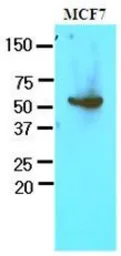 Anti-G6PD antibody [AT2F6] used in Western Blot (WB). GTX53718