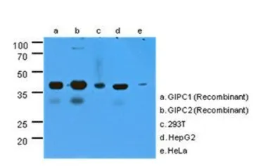 Anti-GIPC antibody [AT1G10] used in Western Blot (WB). GTX53721