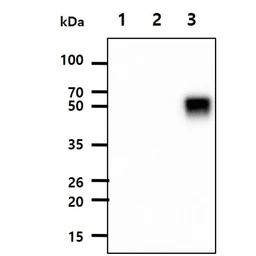 Anti-Influenza A virus H3N2 HA (Hemagglutinin) antibody [AT1B7] used in Western Blot (WB). GTX53724