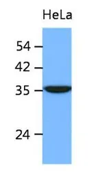 Anti-ING2 antibody [AT39E5] used in Western Blot (WB). GTX53732
