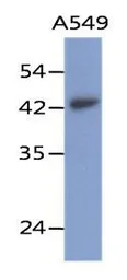 Anti-Layilin antibody [AT20G8] used in Western Blot (WB). GTX53736