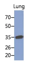 Anti-MFAP4 antibody [AT12D11] used in Western Blot (WB). GTX53740