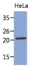 Anti-MYL4 antibody [AT4E8] used in Western Blot (WB). GTX53747