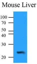 Anti-NQO2 antibody [AT1E3] used in Western Blot (WB). GTX53753