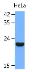 Anti-Park7 / DJ-1 antibody [AT1E12] used in Western Blot (WB). GTX53756