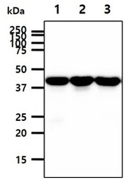 Anti-PPM1A antibody [p6c7] used in Western Blot (WB). GTX53766