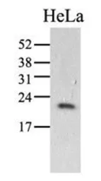 Anti-Cyclophilin C antibody [AT3C6] used in Western Blot (WB). GTX53767