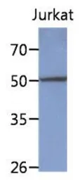 Anti-PPM1F antibody [AT6D11] used in Western Blot (WB). GTX53769
