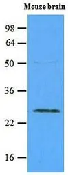 Anti-RAB5A antibody [3A4] used in Western Blot (WB). GTX53775