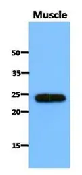 Anti-SAR1B antibody [AT1C7] used in Western Blot (WB). GTX53780
