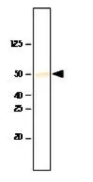 Anti-SETD7 antibody [s4E5] used in Western Blot (WB). GTX53782