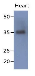 Anti-delta Sarcoglycan antibody [AT19G8] used in Western Blot (WB). GTX53783