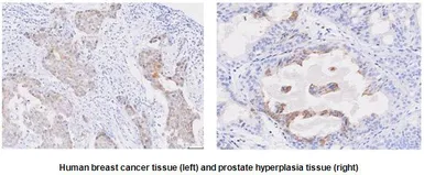 Anti-STEAP1 antibody [J2D2] used in IHC (Paraffin sections) (IHC-P). GTX53786