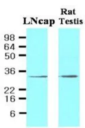 Anti-STEAP1 antibody [J2D2] used in Western Blot (WB). GTX53786