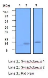 Anti-VAMP2 antibody [3E5] used in Western Blot (WB). GTX53789