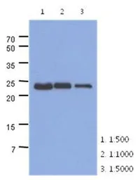 Anti-TNNI1 antibody [AT36E7] used in Western Blot (WB). GTX53792