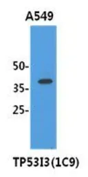 Anti-PIG3 antibody [AT1C9] used in Western Blot (WB). GTX53794