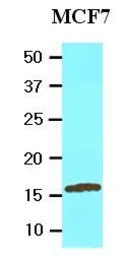 Anti-UBE2L6 antibody [k1H3] used in Western Blot (WB). GTX53796