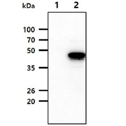 Anti-SERPINA12 antibody [1C4] used in Western Blot (WB). GTX53798