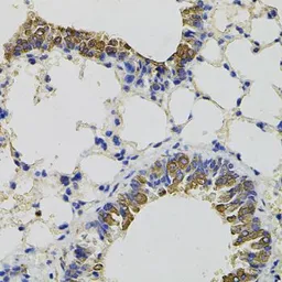Anti-CD59 antibody used in IHC (Paraffin sections) (IHC-P). GTX53909