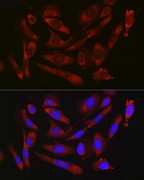 Anti-CD47 antibody used in Immunocytochemistry/ Immunofluorescence (ICC/IF). GTX53912