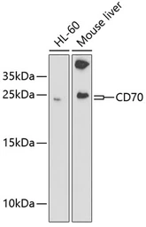 Anti-CD70 antibody used in Western Blot (WB). GTX53916