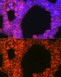 Anti-CD70 antibody used in Immunocytochemistry/ Immunofluorescence (ICC/IF). GTX53916