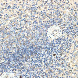 Anti-CD70 antibody used in IHC (Paraffin sections) (IHC-P). GTX53916