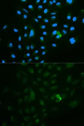 Anti-CD79b antibody used in Immunocytochemistry/ Immunofluorescence (ICC/IF). GTX53917