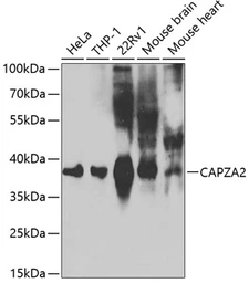 Anti-CAPZA2 antibody used in Western Blot (WB). GTX53918