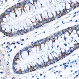 Anti-CAPZA2 antibody used in IHC (Paraffin sections) (IHC-P). GTX53918