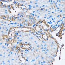 Anti-CAPZA2 antibody used in IHC (Paraffin sections) (IHC-P). GTX53918
