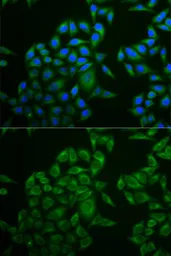 Anti-CD3 zeta antibody used in Immunocytochemistry/ Immunofluorescence (ICC/IF). GTX53919