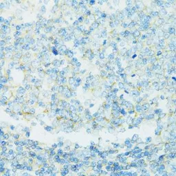 Anti-CD19 antibody used in IHC (Paraffin sections) (IHC-P). GTX53921