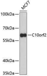 Anti-Twinkle antibody used in Western Blot (WB). GTX53922