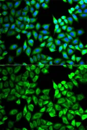 Anti-Twinkle antibody used in Immunocytochemistry/ Immunofluorescence (ICC/IF). GTX53922