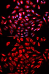 Anti-CaMKIV antibody used in Immunocytochemistry/ Immunofluorescence (ICC/IF). GTX53923