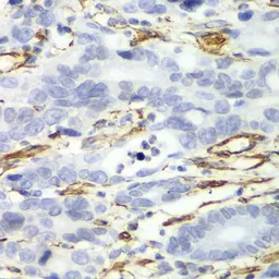 Anti-Caldesmon antibody used in IHC (Paraffin sections) (IHC-P). GTX53924