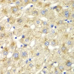 Anti-Caldesmon antibody used in IHC (Paraffin sections) (IHC-P). GTX53924